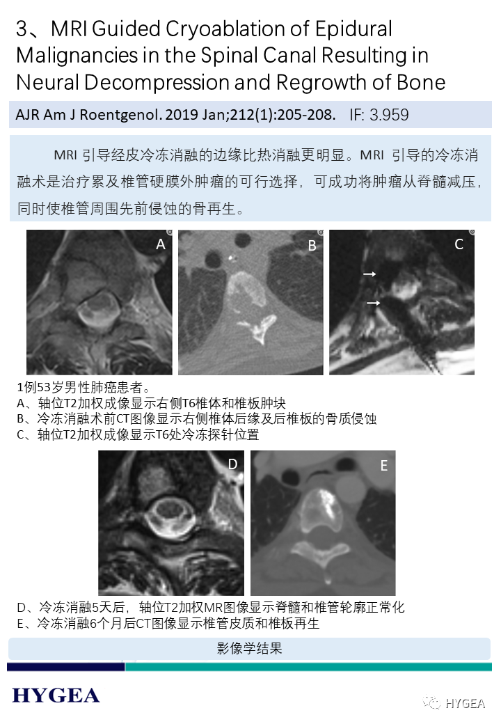 Hv6oqnaEdsghvP3SRCB2xwZRMvzlDzI0oO5bILRZ