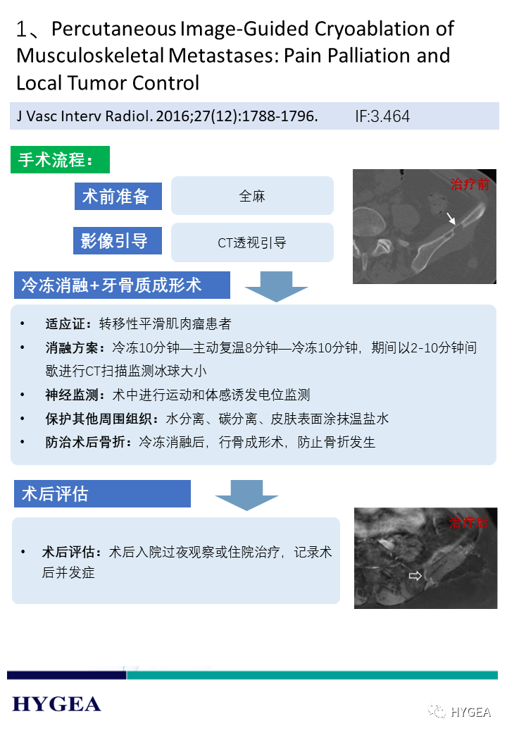 sd8rrBG960KpRTFZ48QG5Cbqt4YEH7KA2dx7Oj0h