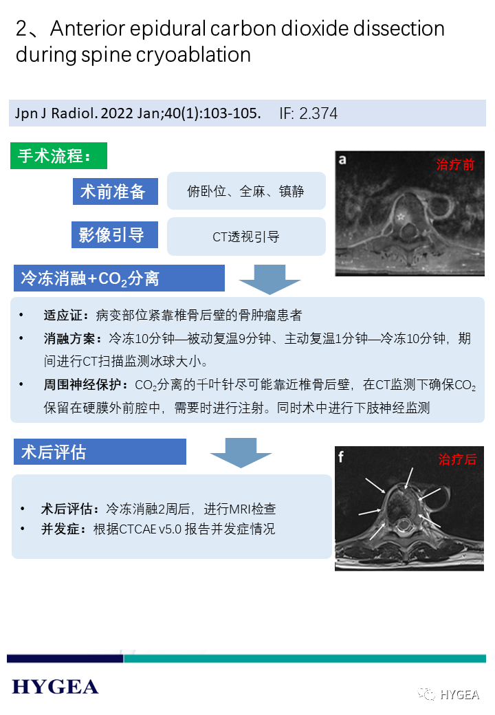 yK3Ur3ky5sLyP5z2S5MSu7jtgukuk4lyUUllvjYi
