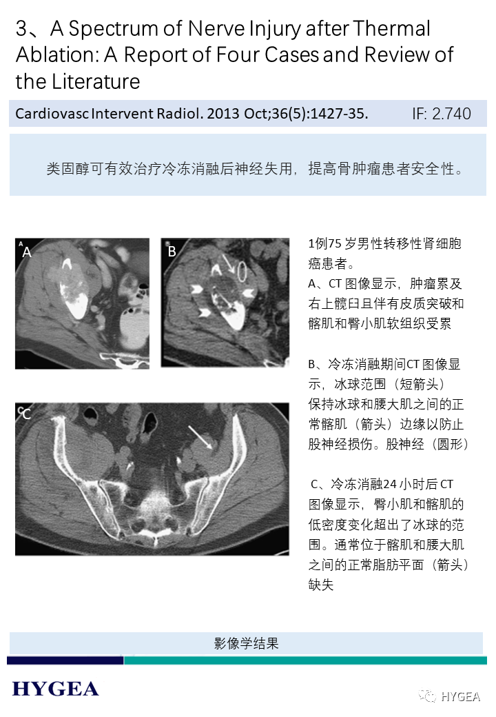 4JOTbuAxV0lPmwYd4UoJXzg3A7JOAiLsRV6WcIY7
