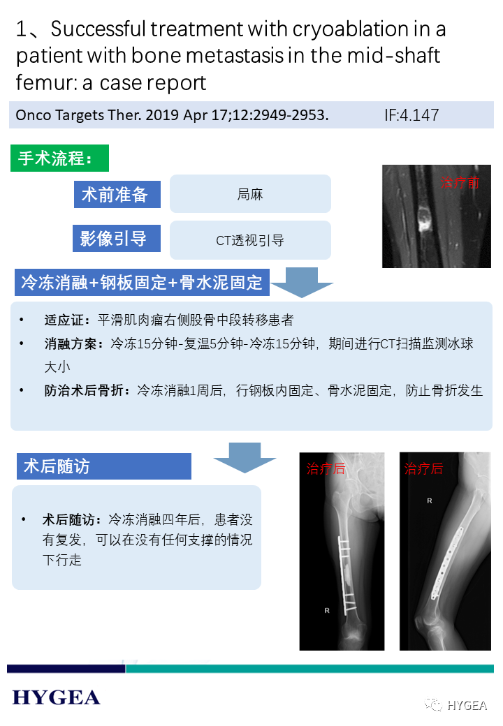AF8v5lJ8zhjGxdn9blCNG6Yviva06ChzcAzwIrMr