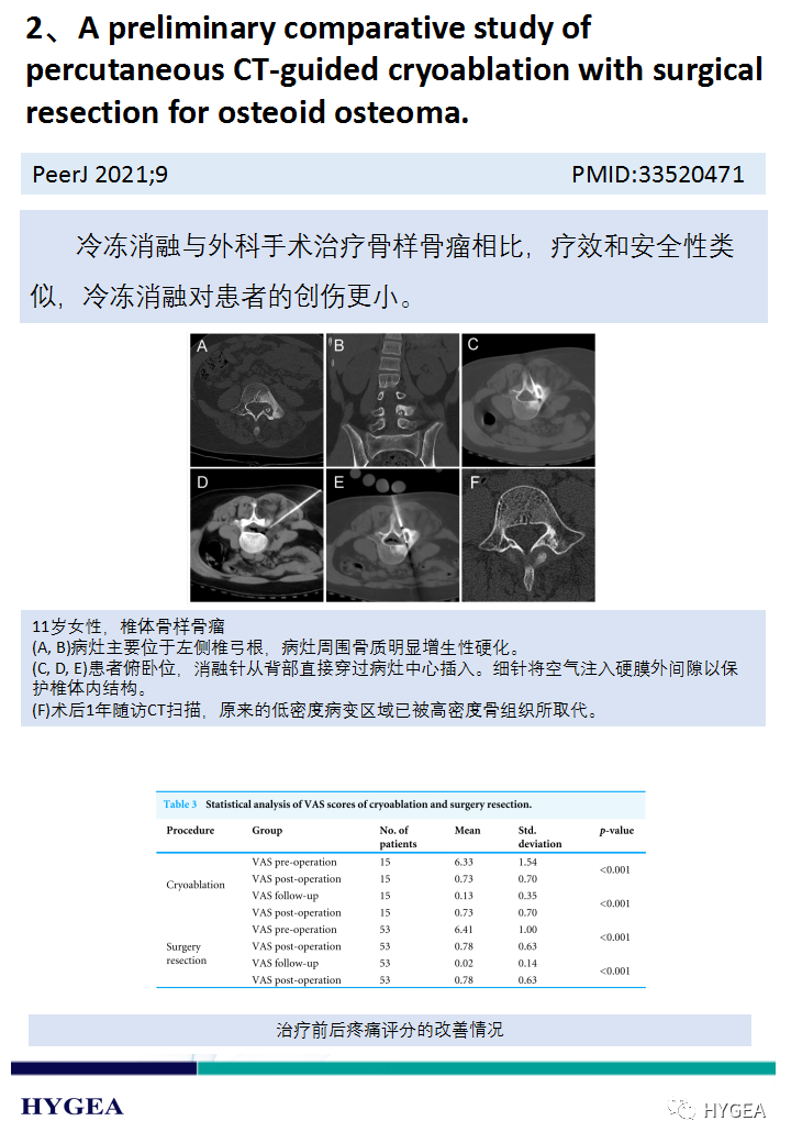 CWwVpXv3mAFJQPEpJZUwE2WlKBwdnkVPcurLsprl