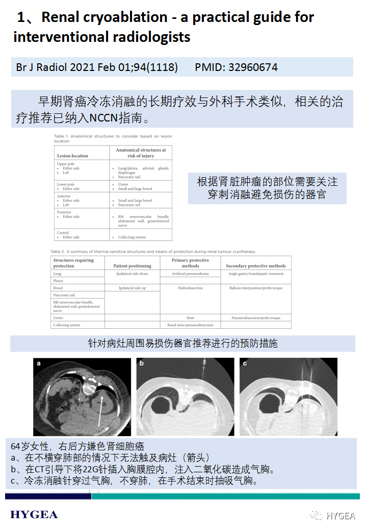 IHImtEUUROsGLAYCcr8jn8cMklJpu9Uhd58Y1pXH