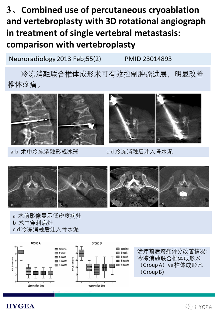 TSBOw9Nqkl4ielwgwcC5z8eSYSZQAC5yJELqdue6