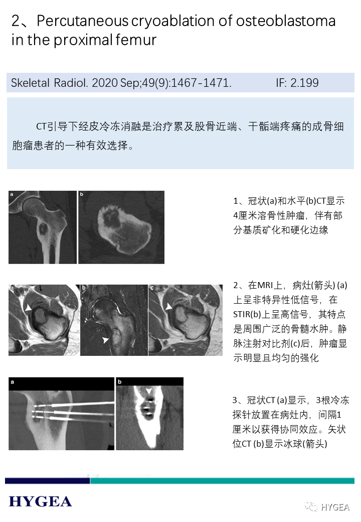 TYconkK43on256tJMFPnSXYPnW57Fihuaqm9x2Nt