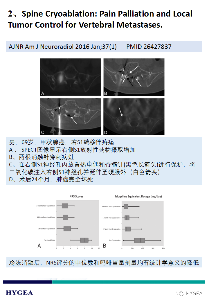 UaKe4qUpTfwcLGu7C0ZsgIVfBBrJqRGGhKUwItr8