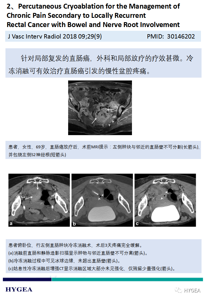 XGNgKxucMHMVLWAElw31xARYNBaZYjQGPATkXVon