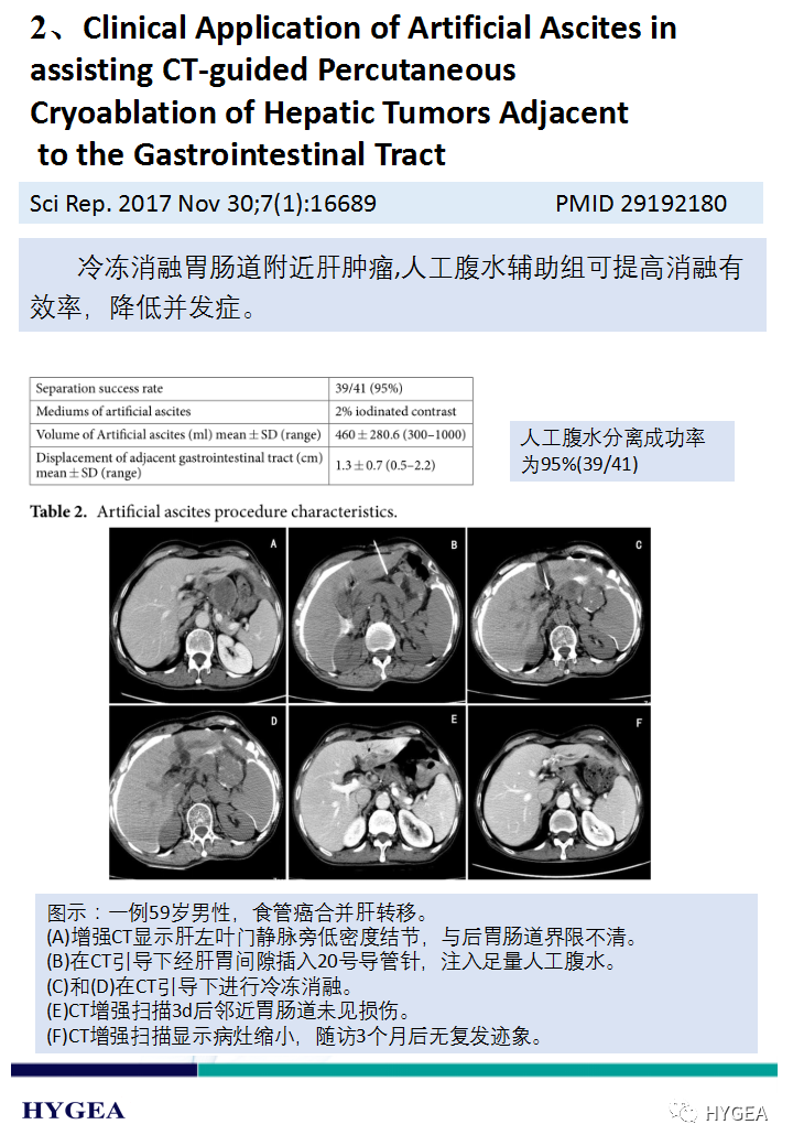 b2saC56d1QKClcokj4ZJmX8fhS3E8zKJiA9au3tR
