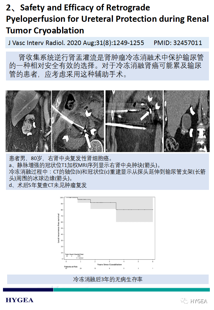 bAdXlNbtmp69s6XKfGPd4K3EvaTIr8CI2yQxz9Vh