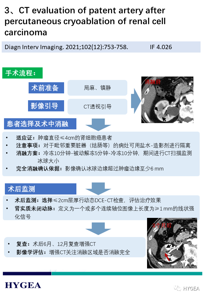 hKiAPi1HJFRN0AD58Ggis8pDe3IJyuTlJCfMBRSB