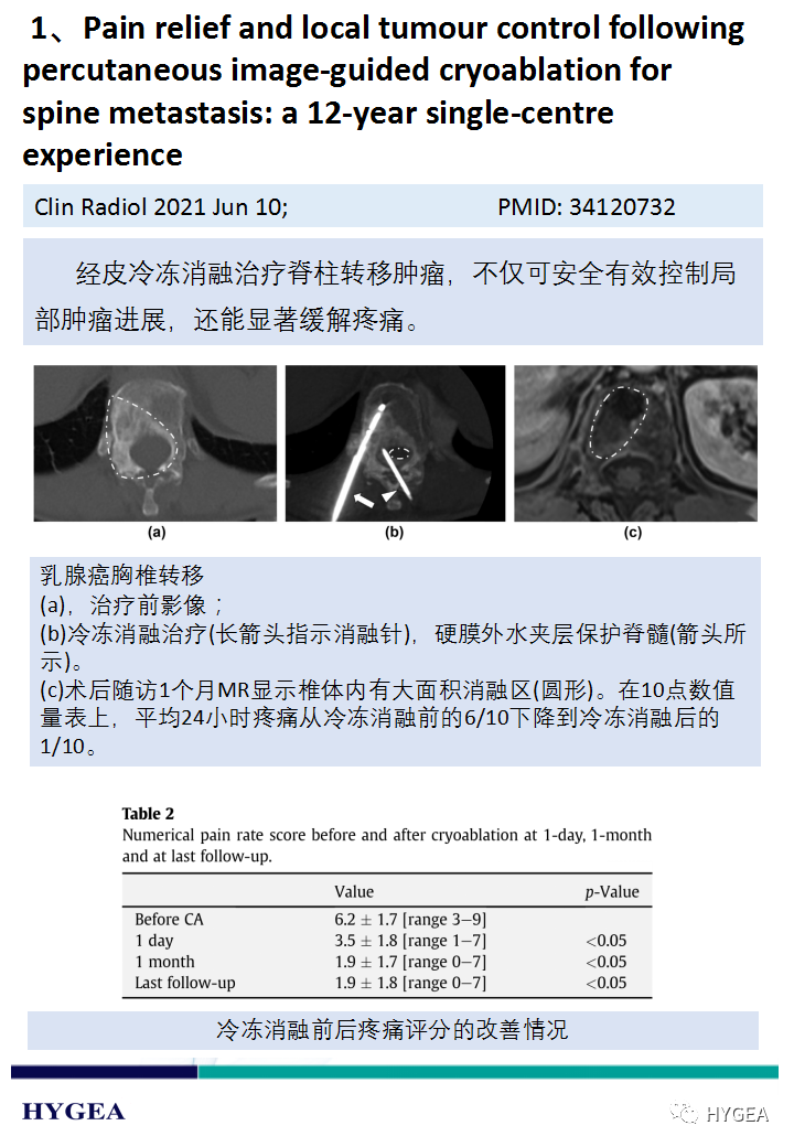 htH3qugNBQTLnLCzXNcqEqRQLhfpq09OhaiOBRKZ