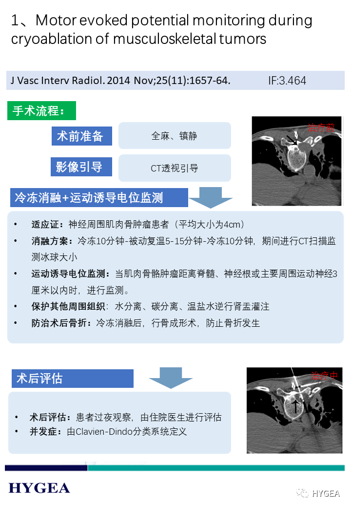 j9ALYmgltQ9s8vCNDKAwTgkHDlMjOoZqewIxzhvi