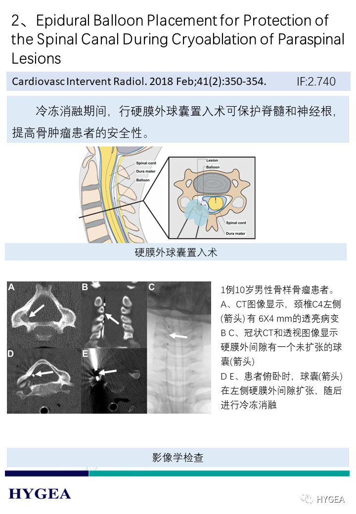 vrZX9nLedLvzxJFvE9Q2XuUq4wxFnbhrPvcjbBiO