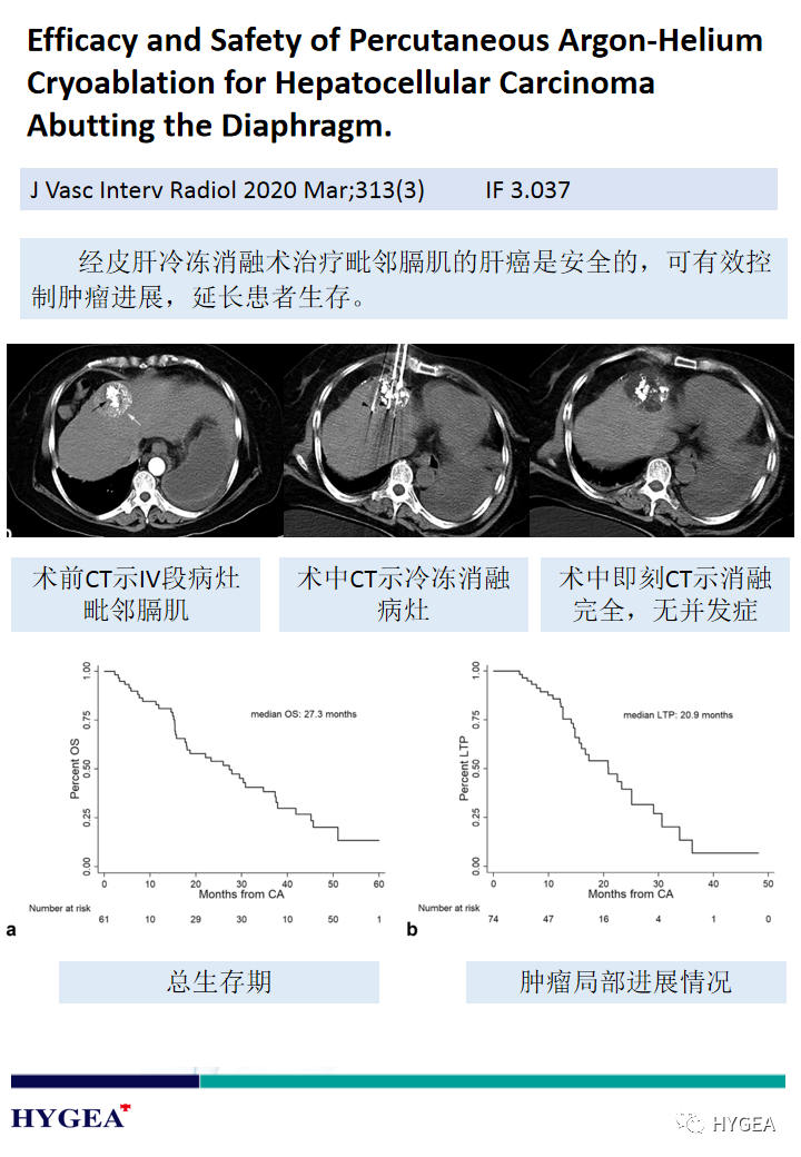 2DOO1E3pdEvZTDNv8irAzxlWzXFwduhiUXhSqVGR