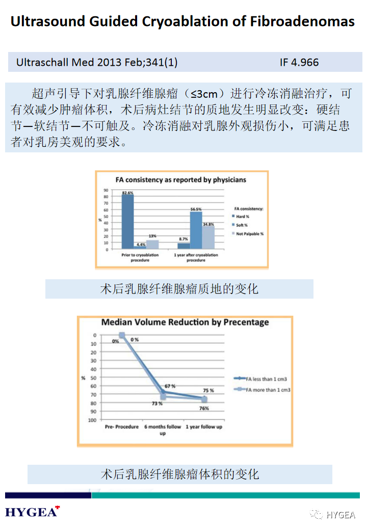 HHkfsWsomECstMdOGbLIVrB2AuAWt5Bu9V7lf0G6