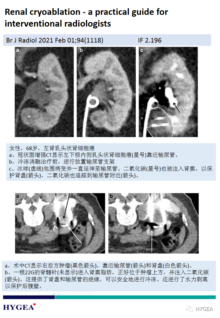 KwRD1qRSrN4xlm94Mq7ayyPVwHLVg9FcjsbRW7LH