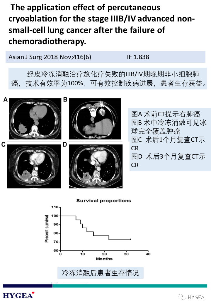 WgciHu4ovNyIHtUKwxmZ79dy8hOTJvjocFLgODQq