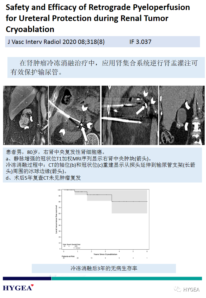 prTsdoOGt0Y8G5TwJaOUnWC9efMGAVxOZCFJ8IeO