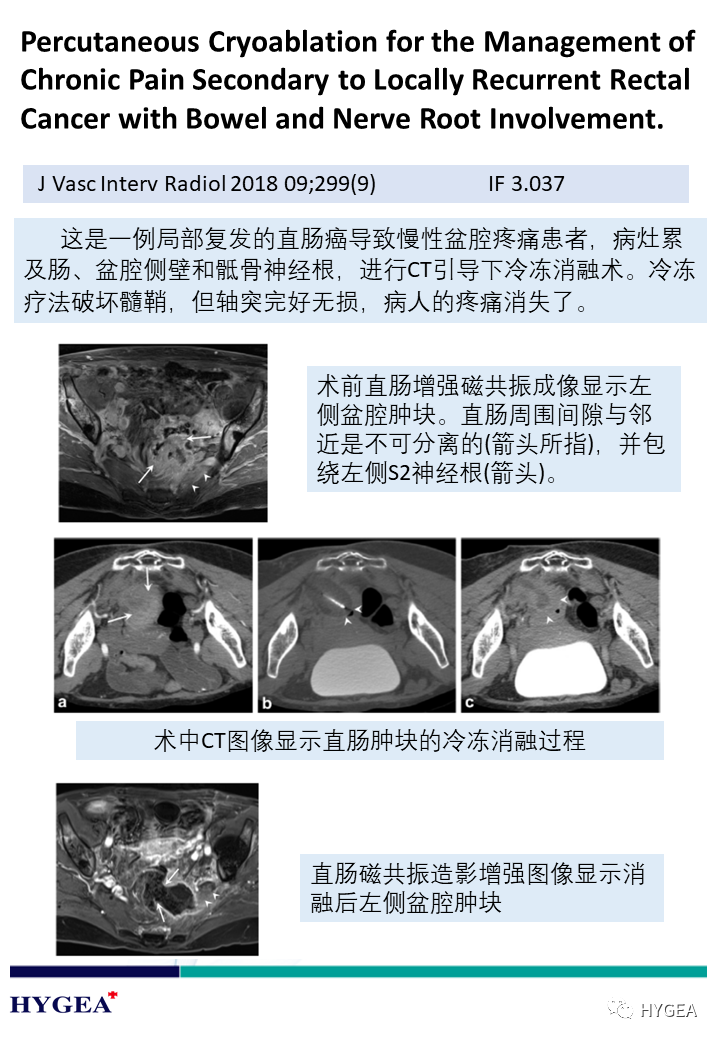 ydn2WVkYFTocKq7GIVZowjG8suQG2ydYTjRx7nBA