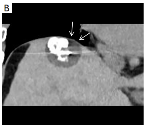 CBbxxAjvfU1wlTYrAi5ooPgqfi5pD5GxTvVSw8lG