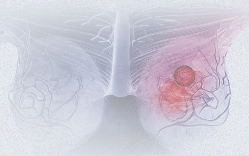 国际妇女节 | 关注乳腺癌 微创染指让俏丽持续，「乳」愿以偿正成为现实