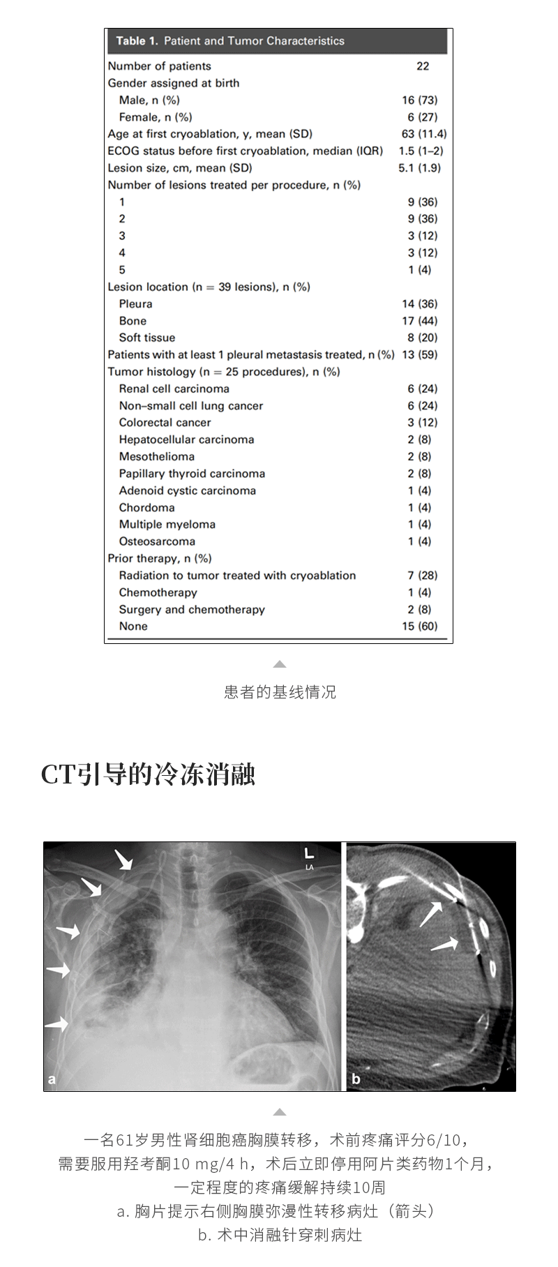 xoaHtj0diaKBJuY91W1Exxz9bPwLAR0s4QqHkiPn
