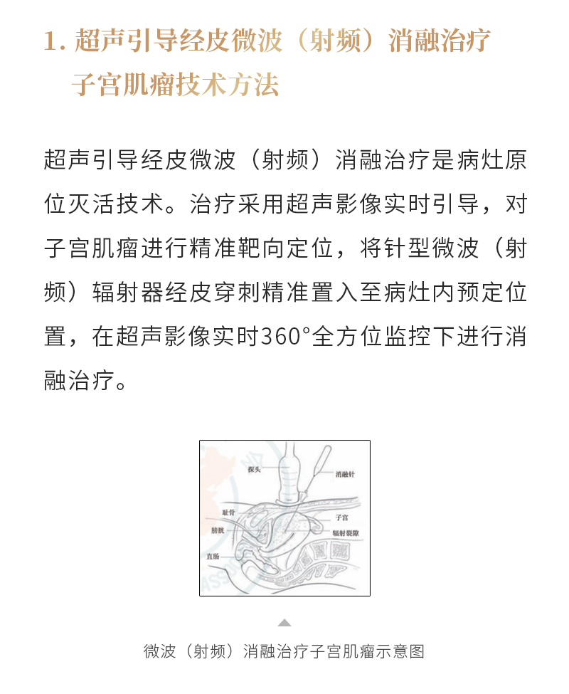 kJwtpyweQdNKezn5CZRlzV8pu9S9v9A0BbPkoEd9