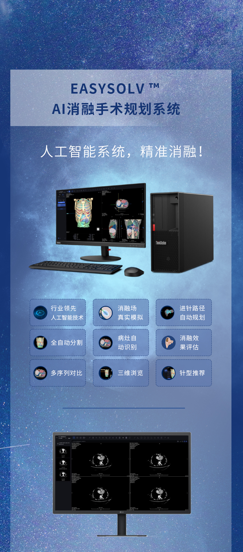 8488Uy9BQi1BimKimXttSHLzCCvHOM2BuesnhBbl