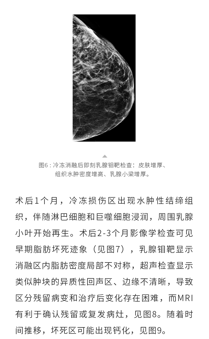 iIpHYeqclaosFtLuLd7niA3O1kKONvON8Tuh6y6f