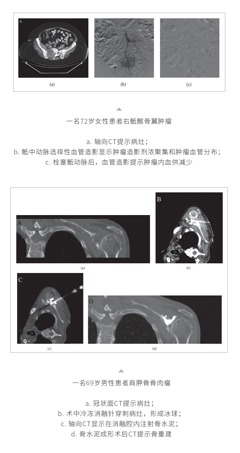 R56G5CC38s3OWLSnZxDBWLbrZupasadL3elo7tOJ