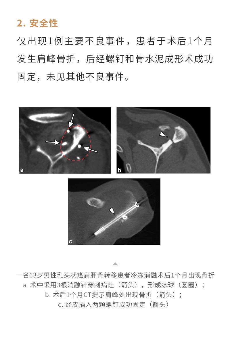 7qb3kK2GL6Uts1RnF9MH533Qro1AaPz0nnW8sxPV