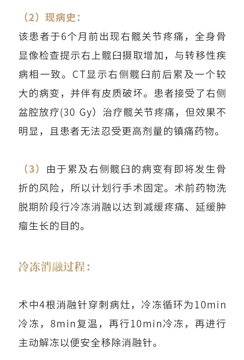 ZVSbbtLHHitpYkFMOUREvrpqp95rZC1O2Xwy15Ko