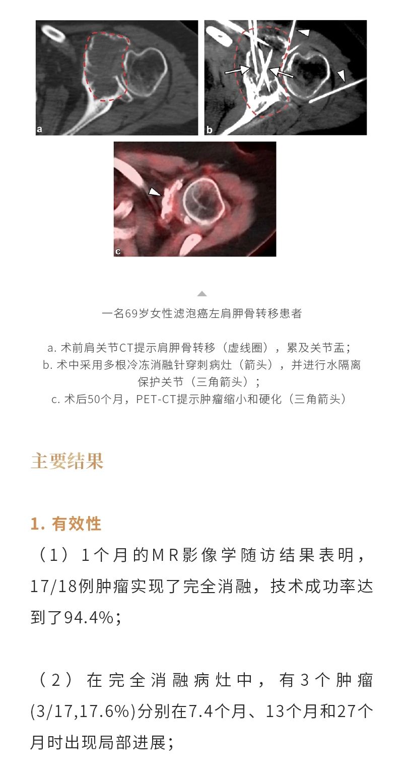 mrocnP3wMzpxFUONTwhwwgNKLejT9sAy2N24vqbM