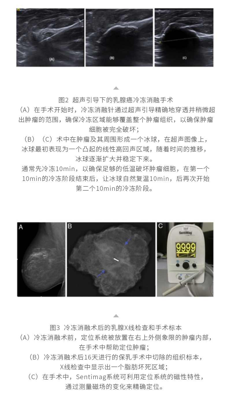 SR1TLloqTUkXk9lgv5A7ARN36lSAxdGb50HHXvZS