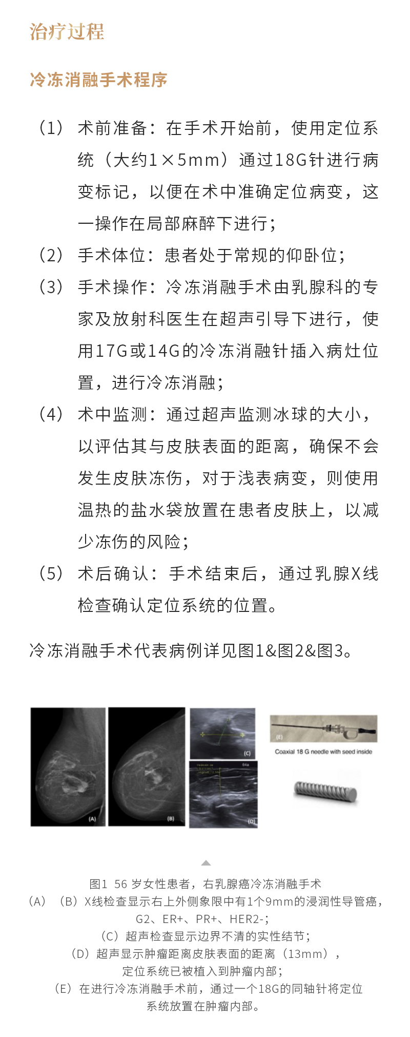 aFcFmAZ0PWrEgj5HhfqT1KOr8BIIiG4bSAQXNVcN