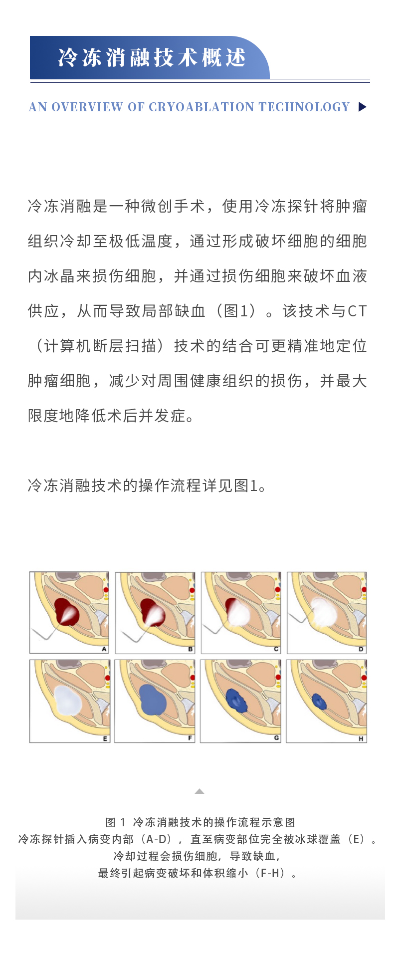 InJNAxZ61dmmffIS5OunPGX39grJpAjWTLHrRtRs