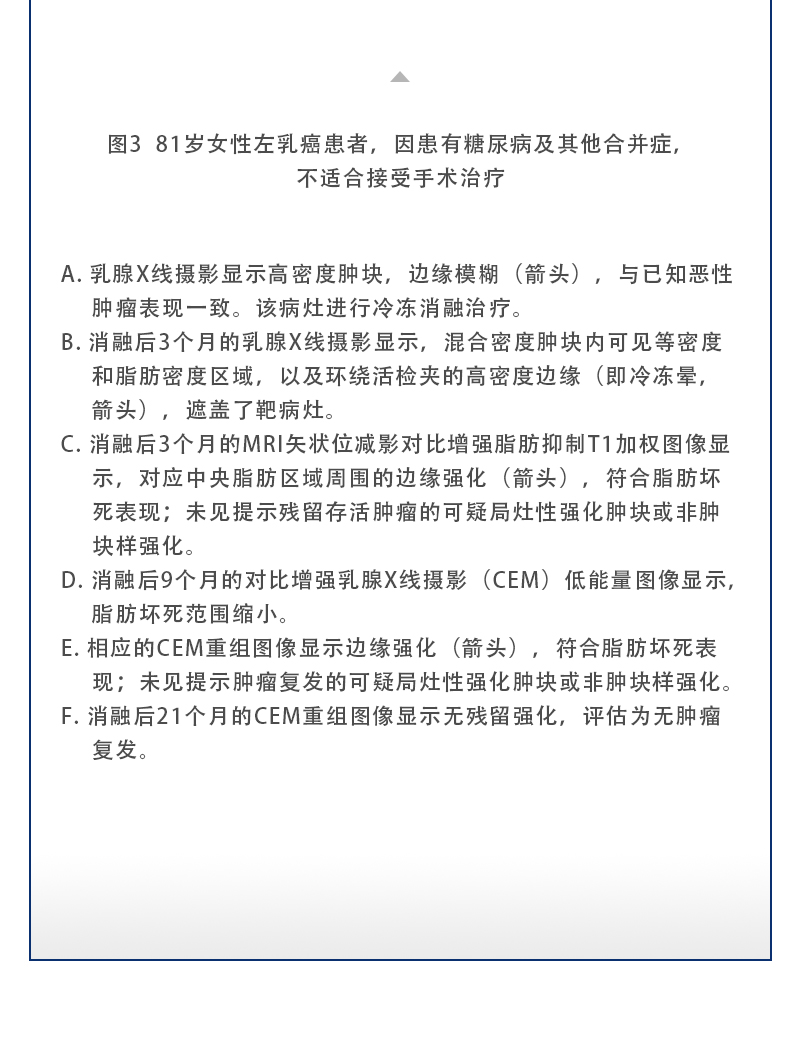 6uBeyj3FDpO64w1PFwj36ShSnIsDxoIMoNjcdWne