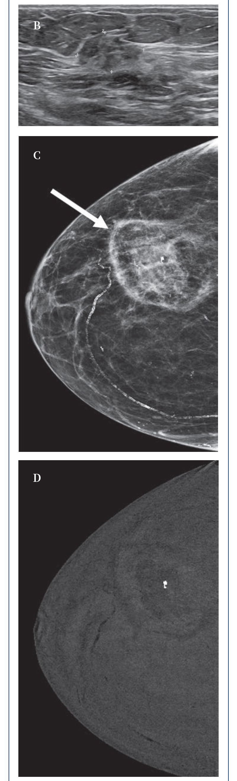 AolhwaFS3A6HhmxSvrzGYIfWmf0jmSv9ymHzwiDj