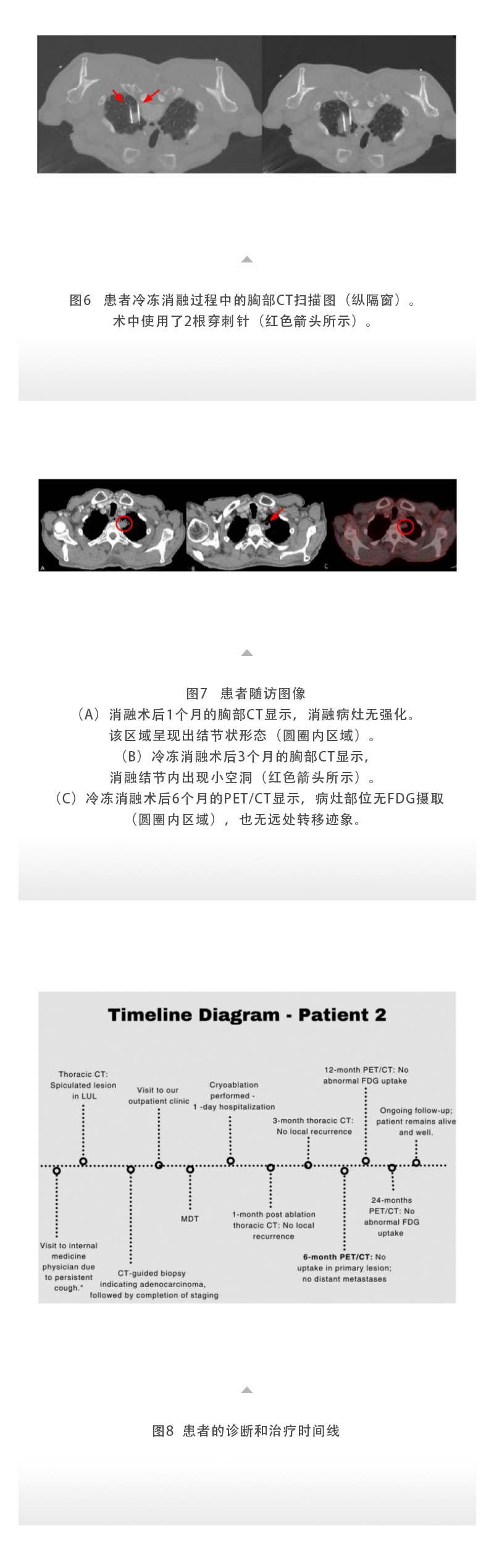 2YeWbZbg8TXXHGsmN6W05jd7fpOIOeRtciAVWh0f