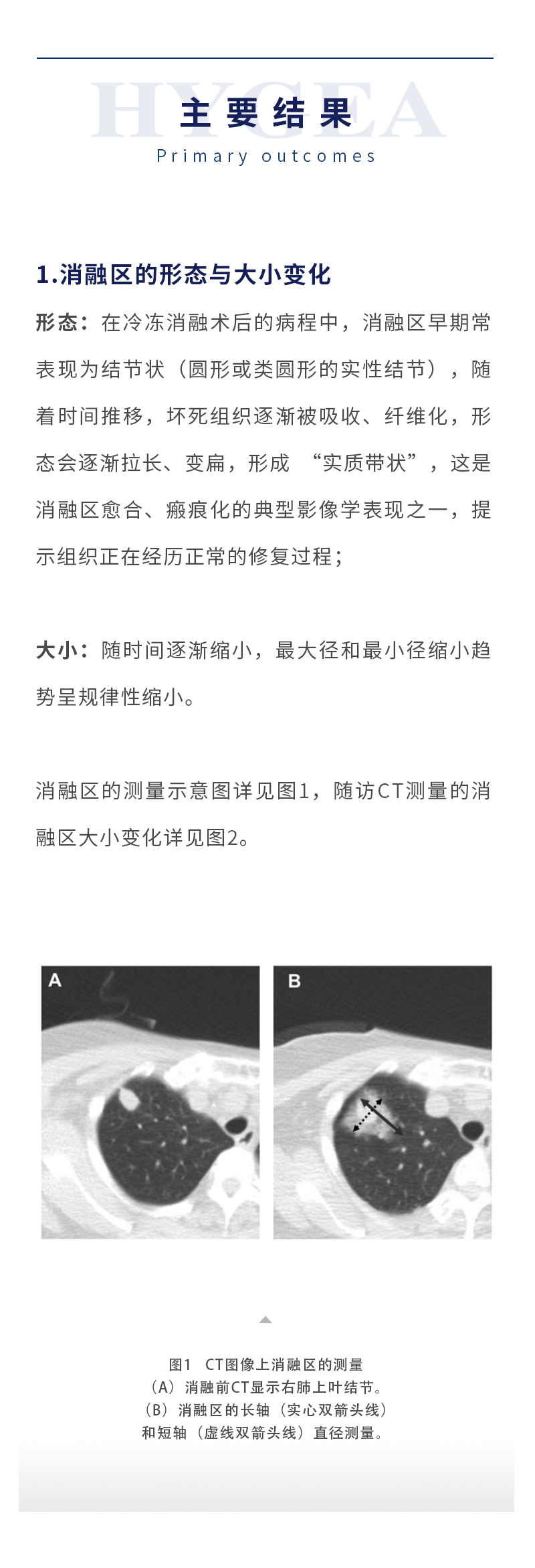 Dd3ZaO2AlJSK7NmEvrtBZrxP70vO6HyiXsGHeM2P