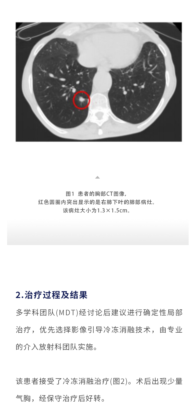 tupUZlfljD0MCOKIldml1F4Va6eBcSKmhn8dn3Ap