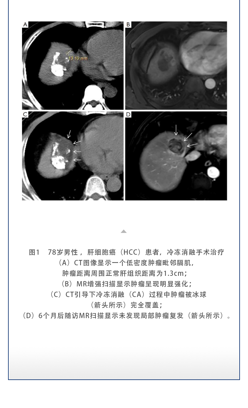 S6M8ZBkM1QgvfFttevykz4dnBna3m2ESsarazaqh