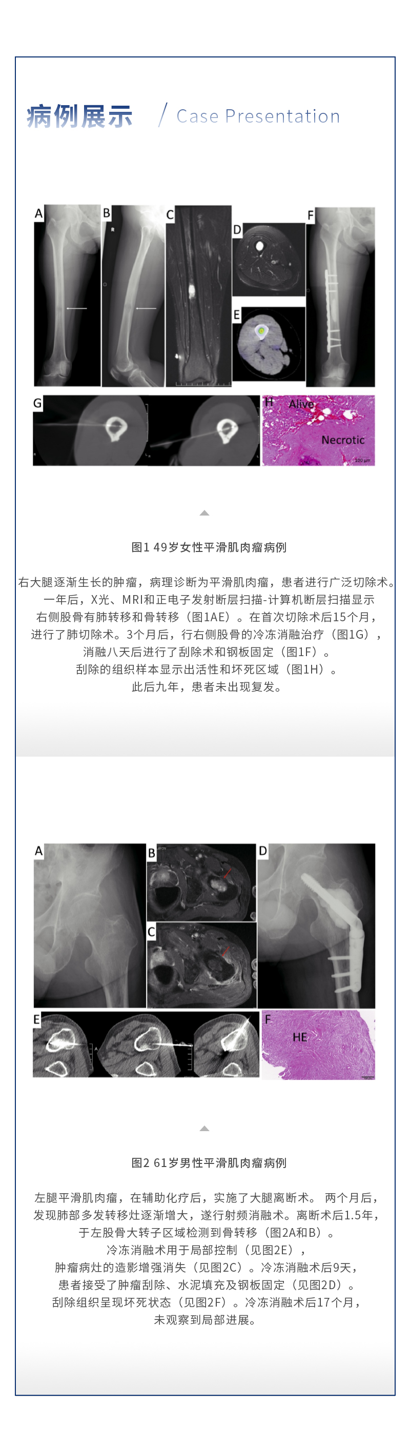 3xMTcCAuMdlo05Lg5xPv1YU7PET0qUjtWczeEGAz