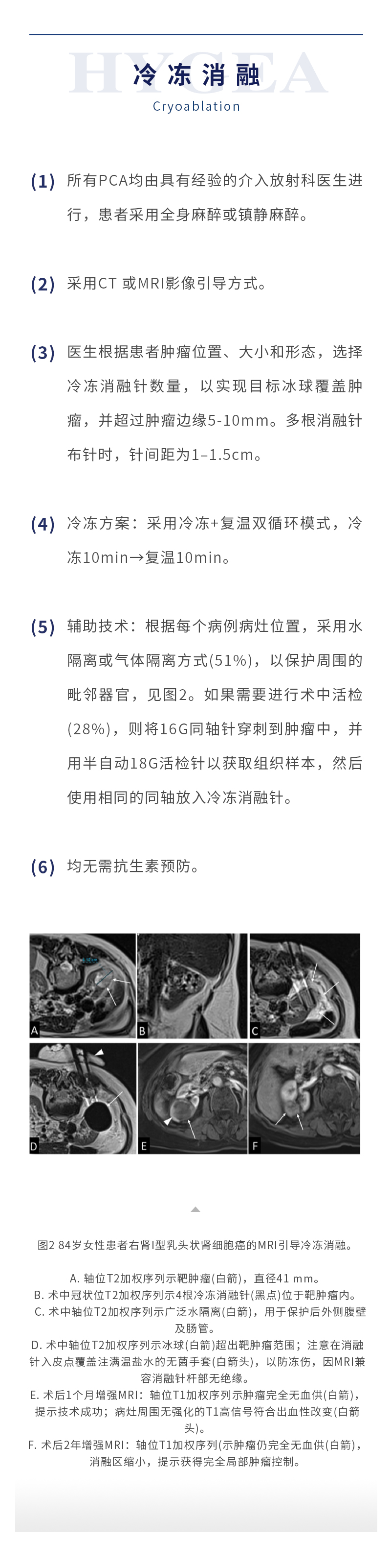 tlpfKHFM3ItTysH0Dnu97Y7FwTujaeKP3ooeOeys