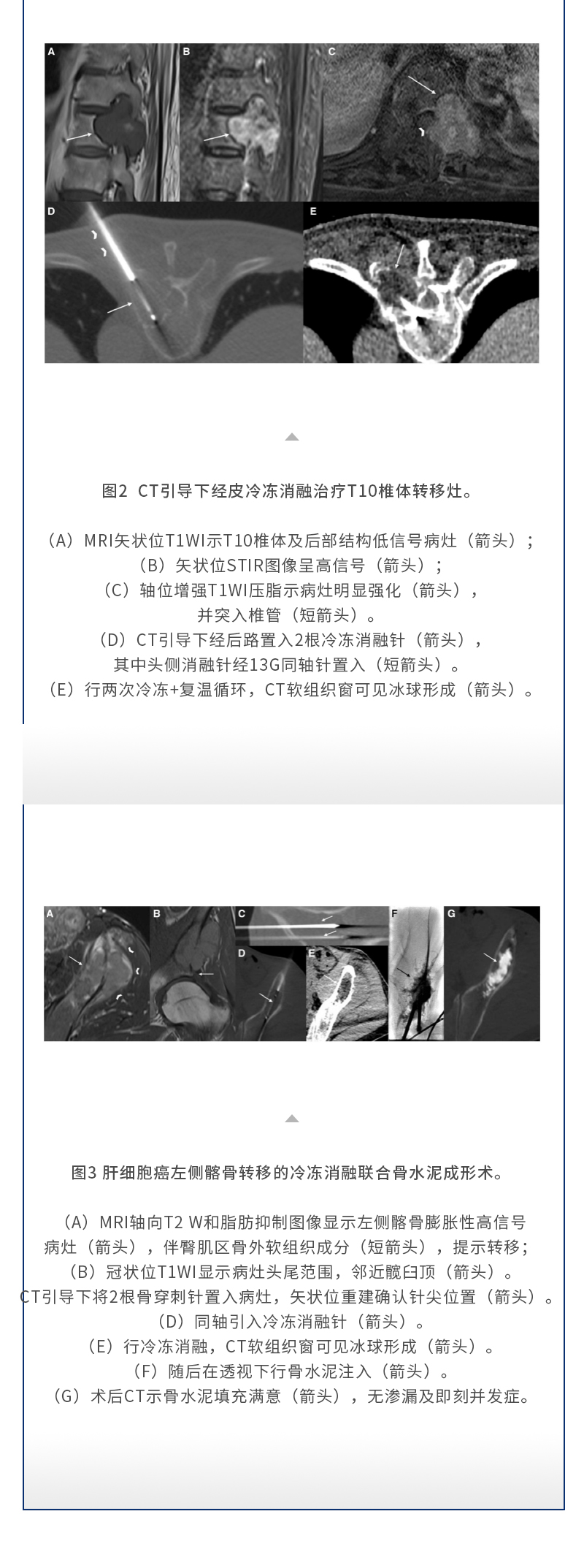 gHjblgnN0ZrsXeuoOA5YzbEM7G2nca4SUhl8LCWS